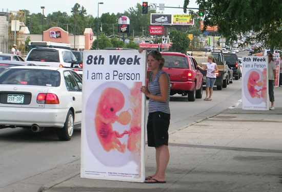 ProLife Preborn Abortion Aborted Baby Sign