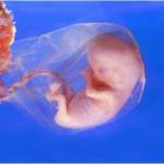 PreBorn Baby 8 Week Gestation